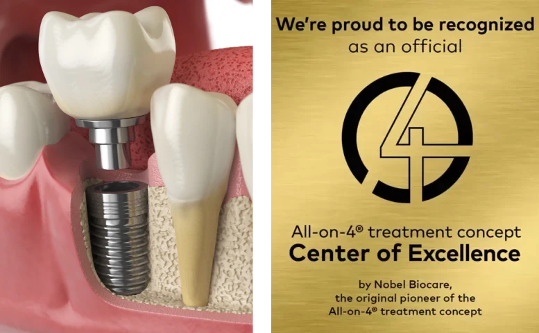 all-on-four-center-of-excellence-axis-dental (1)